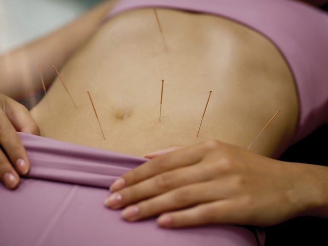 AKUPUNKTURA